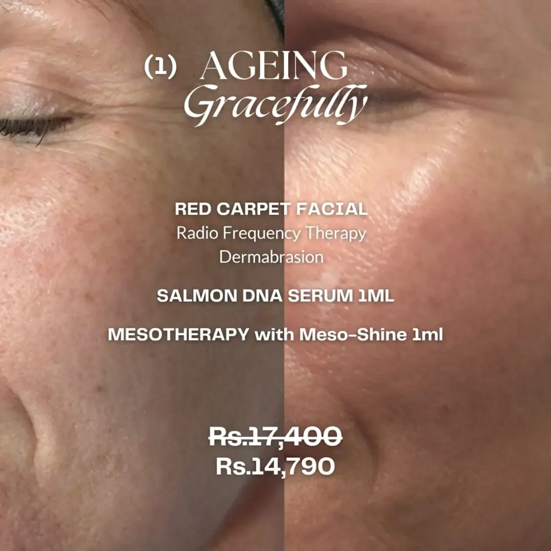 Ageing Gracefully package: Red Carpet facial, salmon DNA serum and mesotherapy in Karachi