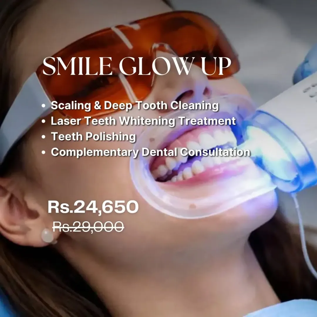 Smile Glow Up deal: scaling, laser teeth whitening and polishing in Karachi
